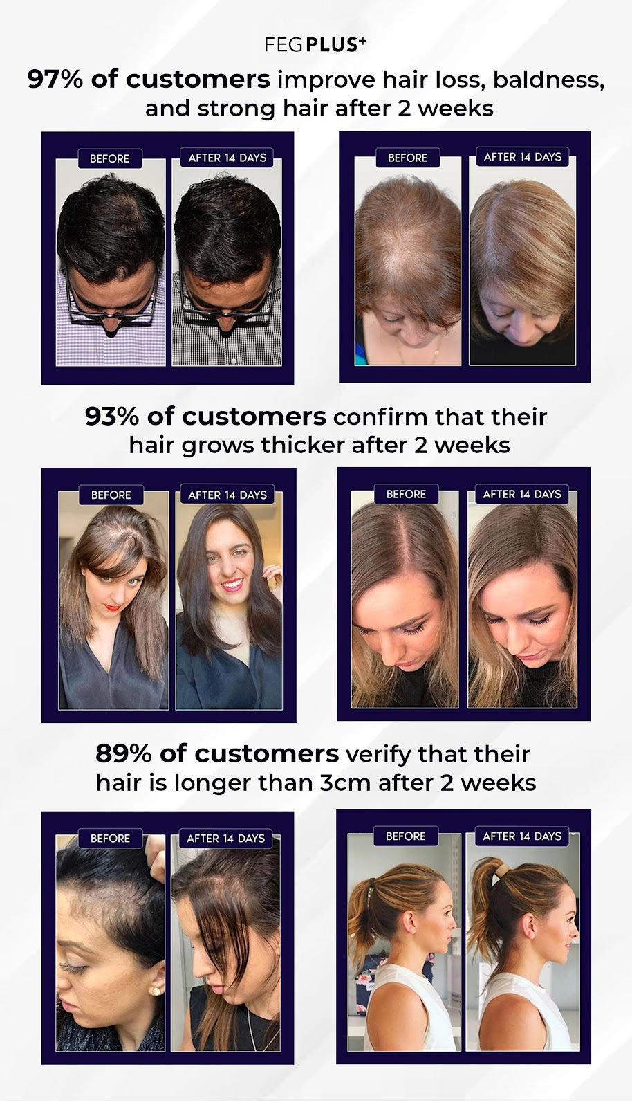 FEG PLUS Hair Growth Spray