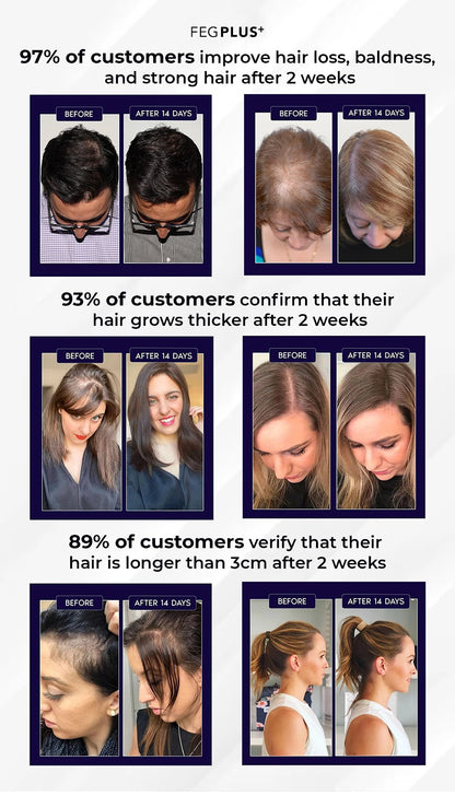 FEG PLUS Hair Growth Spray